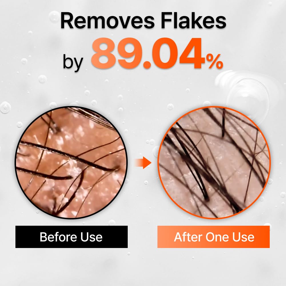 lilyeve Wachsen:TURN Haarausfall Bürstenampulle 100 ml – Kopfhautpflege-Set (+ 100 ml Nachfüllung)