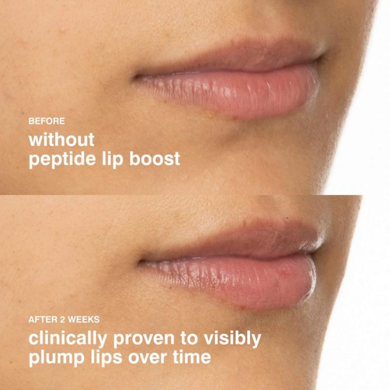 Rhode Peptid Lippen-Booster