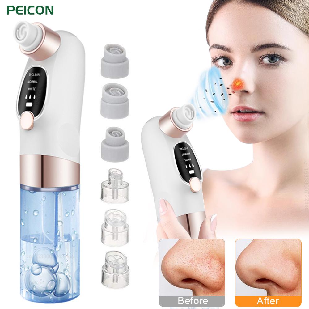 

Blackhead Remover Pore Vacuum Cleaner Multifunctional Cleaning Instrument Small Bubble Facial Cleasing Machine Beauty Device белый