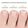 1Pcs Ingrown Toenail Corrector Tools Pedicure Recover Embed Toe Nail Treatment Professional Ingrown Toenail Correction Foot Care