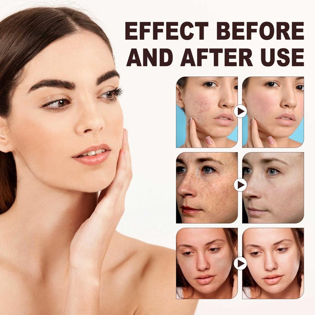 Exfoliating Facial Scrub Peeling Gel Cleaning Face Moisturizing Nourishing Exfoliating Pore Repair Rough Dead Skin Remover Scrub