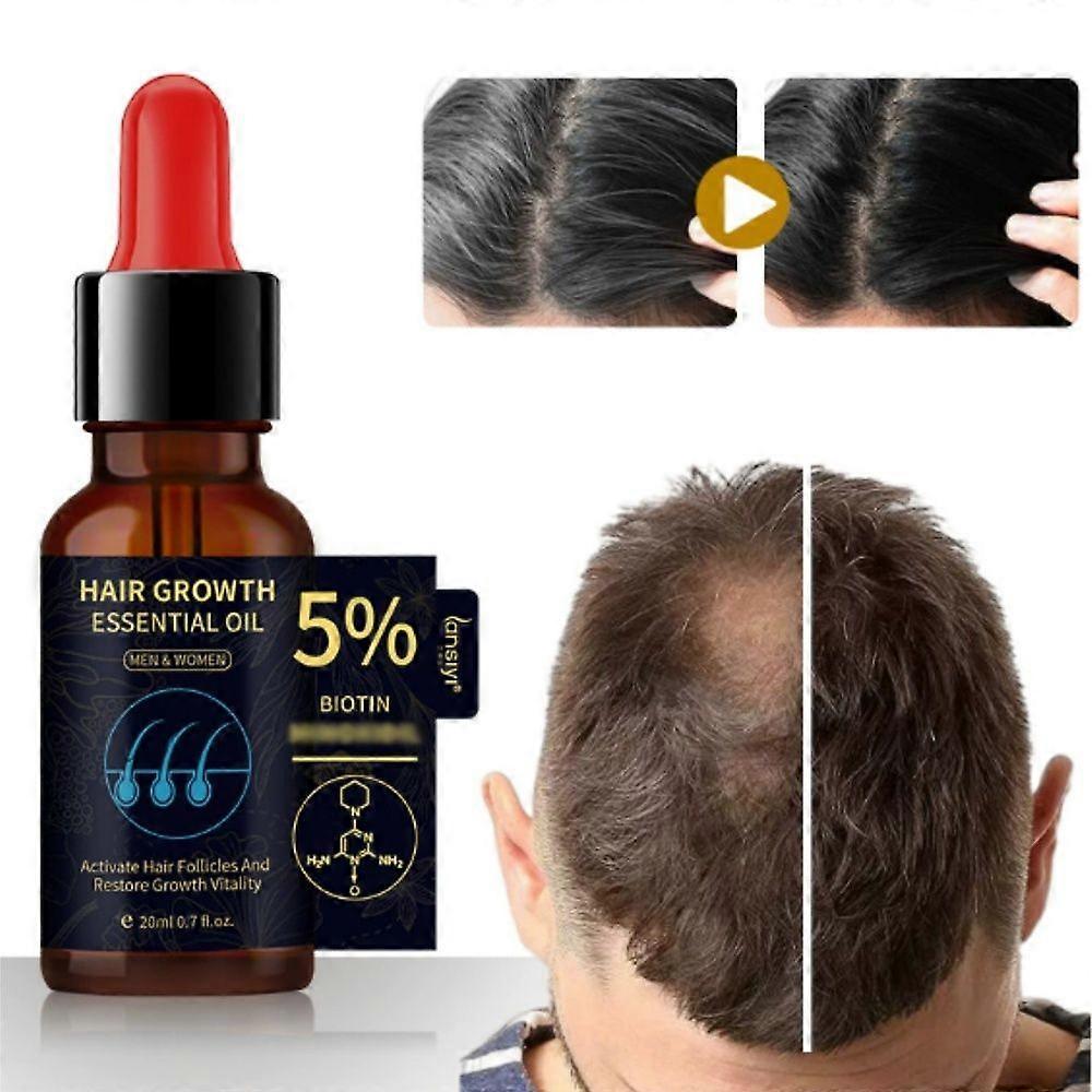 5% Hair Growth Spray, Extra Strength Hair Regrowth Treatments with Biotin 20ml