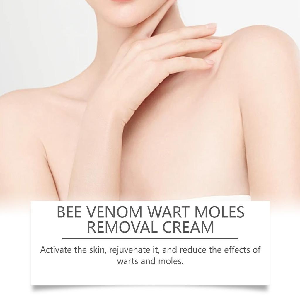 Ximonth Herbal Skin Repair Cream For Gentle Removal And Nourishment Of Skin Tags