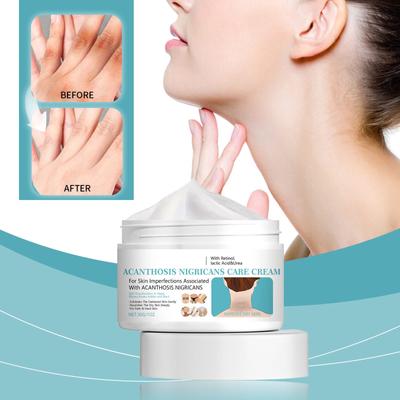 Krém Acanthosis Nigricans, Krém na podpaží, Krém na korekci tmavých skvrn pro odstranění hyperpigmentace, Krém na krk, kotníky.
