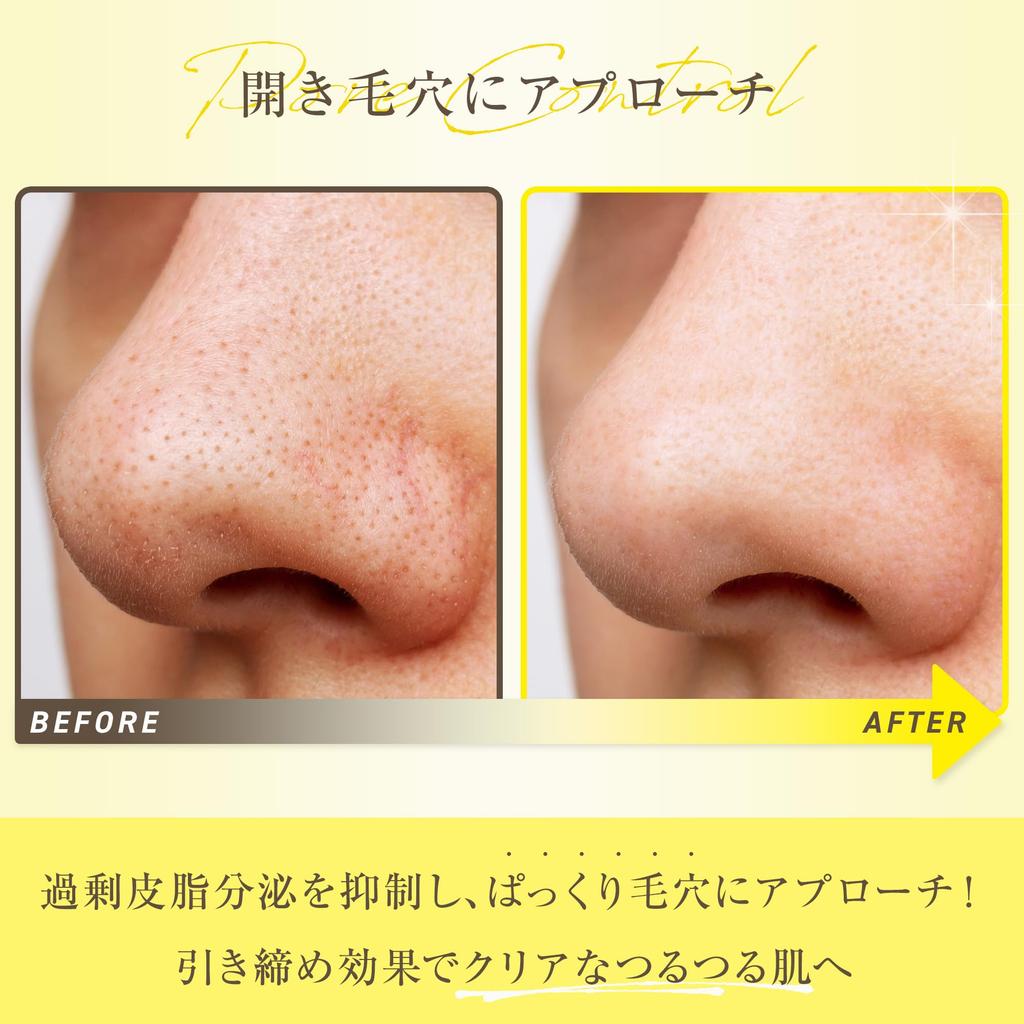 Serum for Pores for Pore for 4 Types of Pore Open Strawberry Pore Control No Vitamin 30ml Dark Rough Makeup Sensitive Hyaluronic Panbesh [Seal Pores,