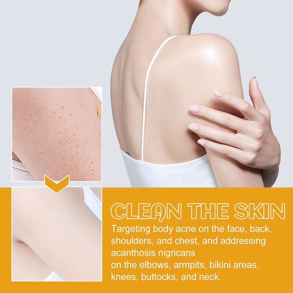 Hautaufhellung für die Achseln, Hautaufhellung für Gesicht und Körper, Aufhellung für Achseln, Hals, Knie, Ellbogen, 120 ml