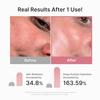 Medikube PDRN Pink Vita Coating Mask Pack