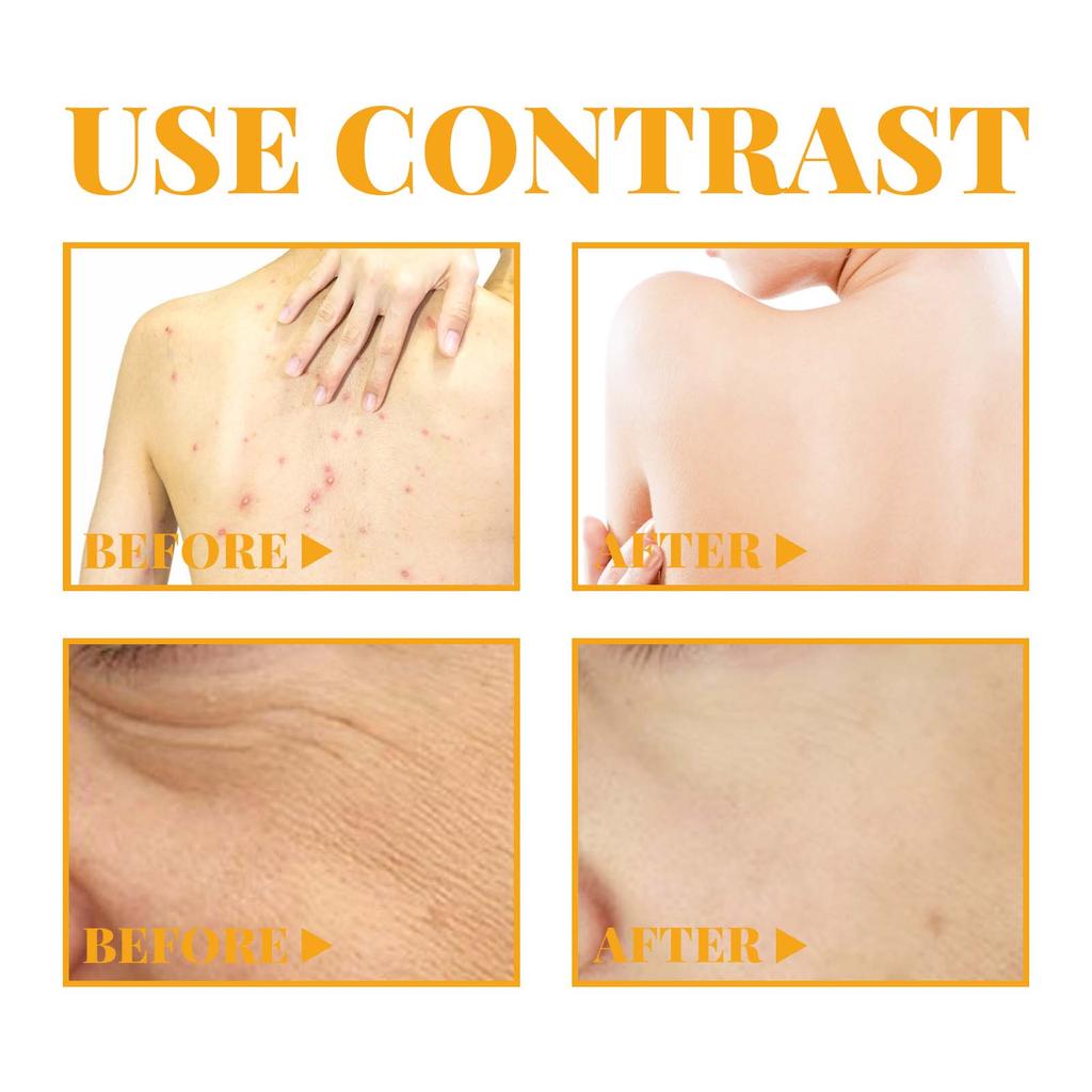 OUHOE Fruit Acid Facial & Body Serum Series Hydrates & Moisturizes Nourishes & Brightens Fades Dark Spots Suitable for Whole Body 100ml