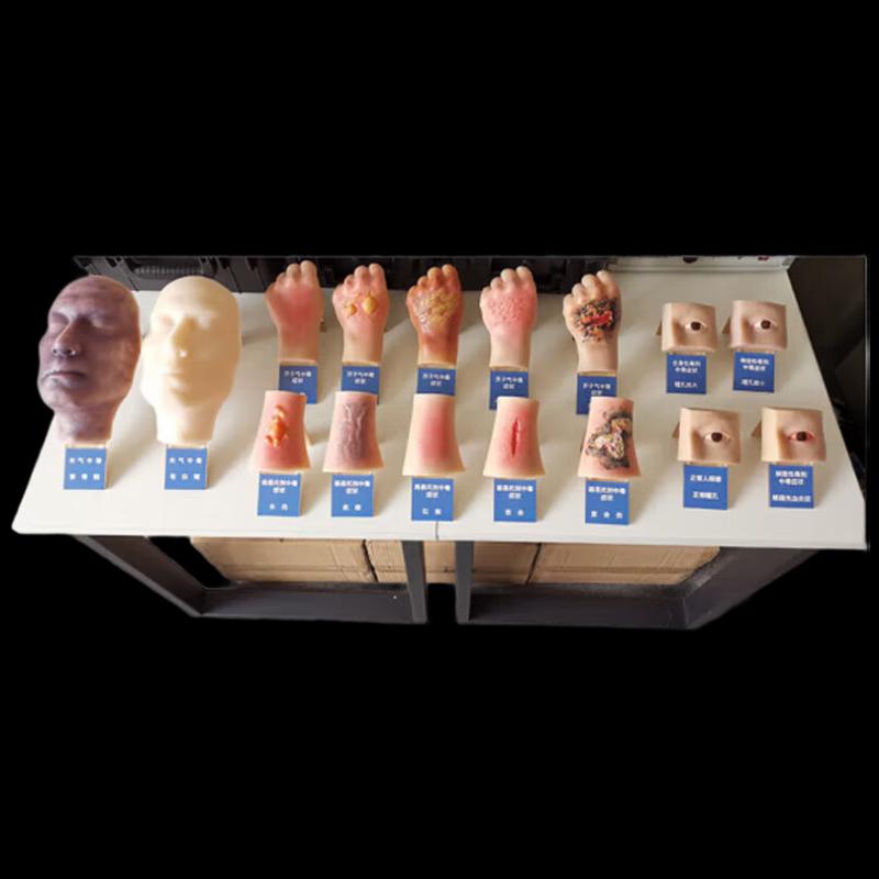 Human Poisoning Simulation Training Model
