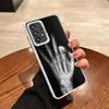 Funny X-Ray Hand Bones Soft Phone Case for Samsung A17 A16 A15 A14 A13 A57 A56 A55 A54 A53 A37 A36 A35 A34 A33 A26 A25 A24 A23 A