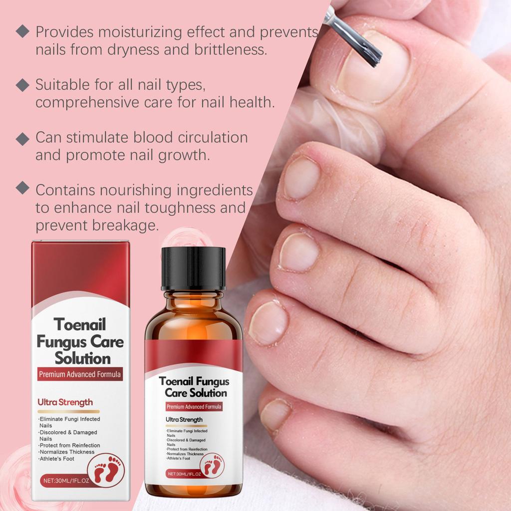 Nail Care Liquid With Herbal Ingredients Gently Nourishes Soft, Thick And Smooth Nail Surfaces,30ML