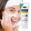 Moisturizing Acne Facial Cleanser with Niacinamide, Arbutin & Hyaluronic Acid - 100g/3.53 Oz, Foam Dense for Dry Skin, Gentle Deep Cleansing & Soothin