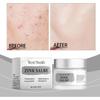 Westmonth Acne Cream Refreshing Oil Control Repair Acne Mild Soothing Closing Face Cream Skin Care155G