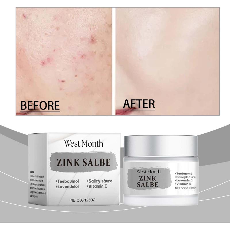 Westmonth Acne Cream Refreshing Oil Control Repair Acne Mild Soothing Closing Face Cream Skin Care155G