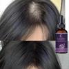 New Hair Growth Products Fast Growing Hair Essential Oil Beauty Hair Care Prevent Hair Loss Oil Scalp Treatment for Men Women