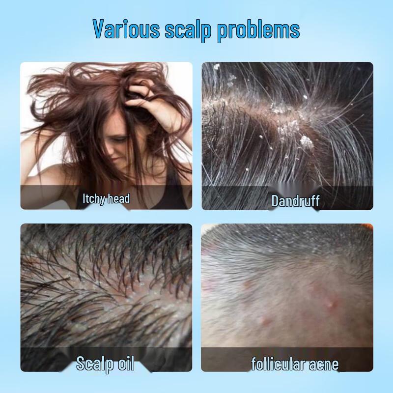 sakose Anti-Dandruff & Oil Control Hair Treatment