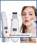 2026 Ultrasonic Face Scrubber Facial Peeling Skin Scrubber Deep Facial Cleaning Spatula Acne Pore  Facial Clean Rechargeable