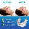 Nastavitelný chránič úst proti chrápání Anti Snore Spánková apnoe Bručení zubů