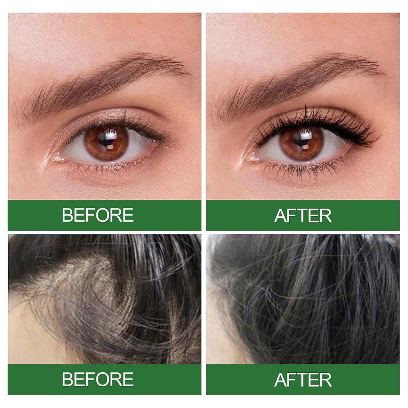 Rosemary Essential Oil Stimulates Hair Growth Skin Care Nourishes Treatment