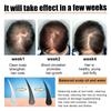 Anti Hair Loss Scrub Smoothing Moisturizing Roots Baldness Treatment Nourish Hair Regeneration Deep Cleansing Scalp Scrub Cream