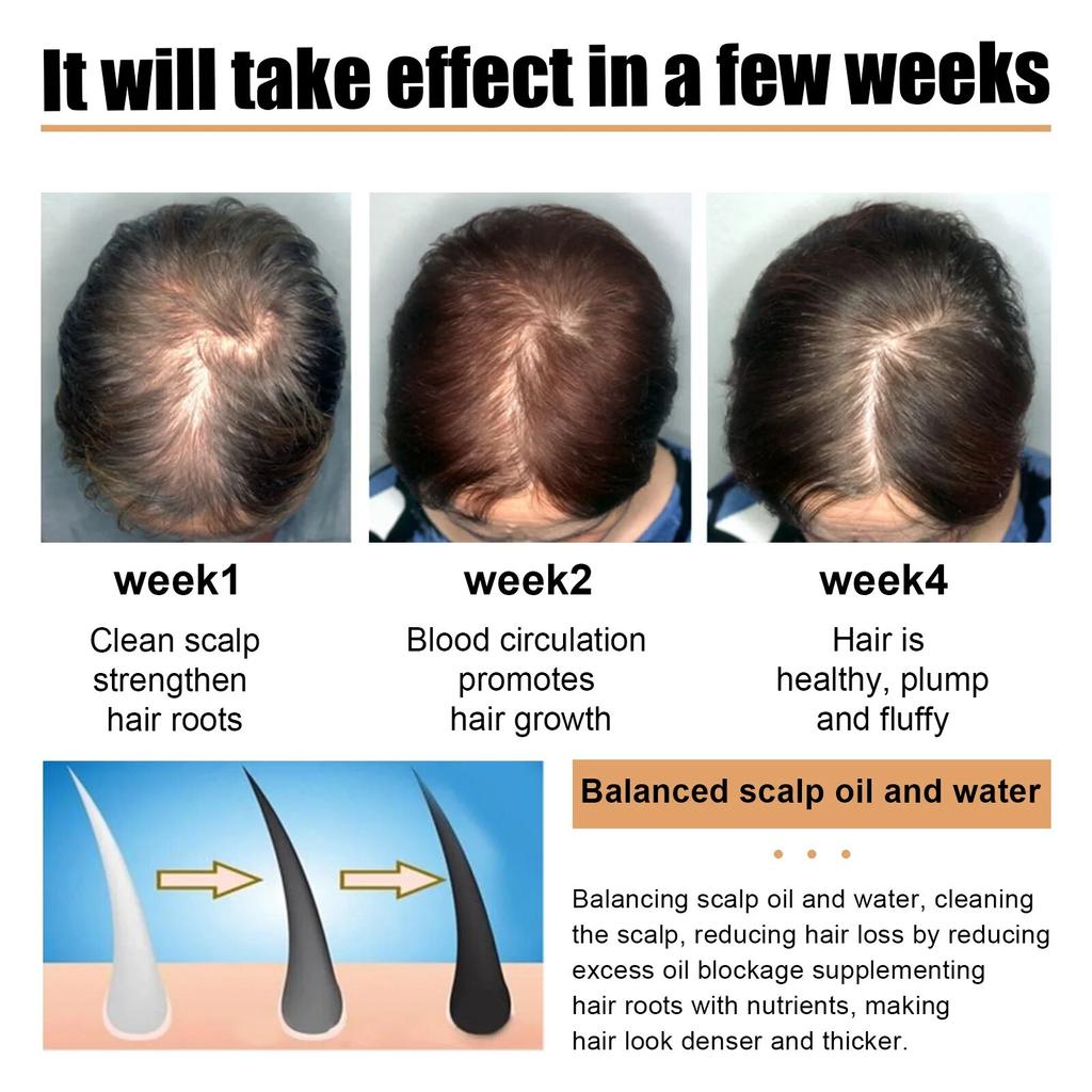Anti Hair Loss Scrub Smoothing Moisturizing Roots Baldness Treatment Nourish Hair Regeneration Deep Cleansing Scalp Scrub Cream