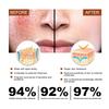 Soothing Repair Serum Redness Relief Hydrating Essence 30ml Face Care Sensitive Skin