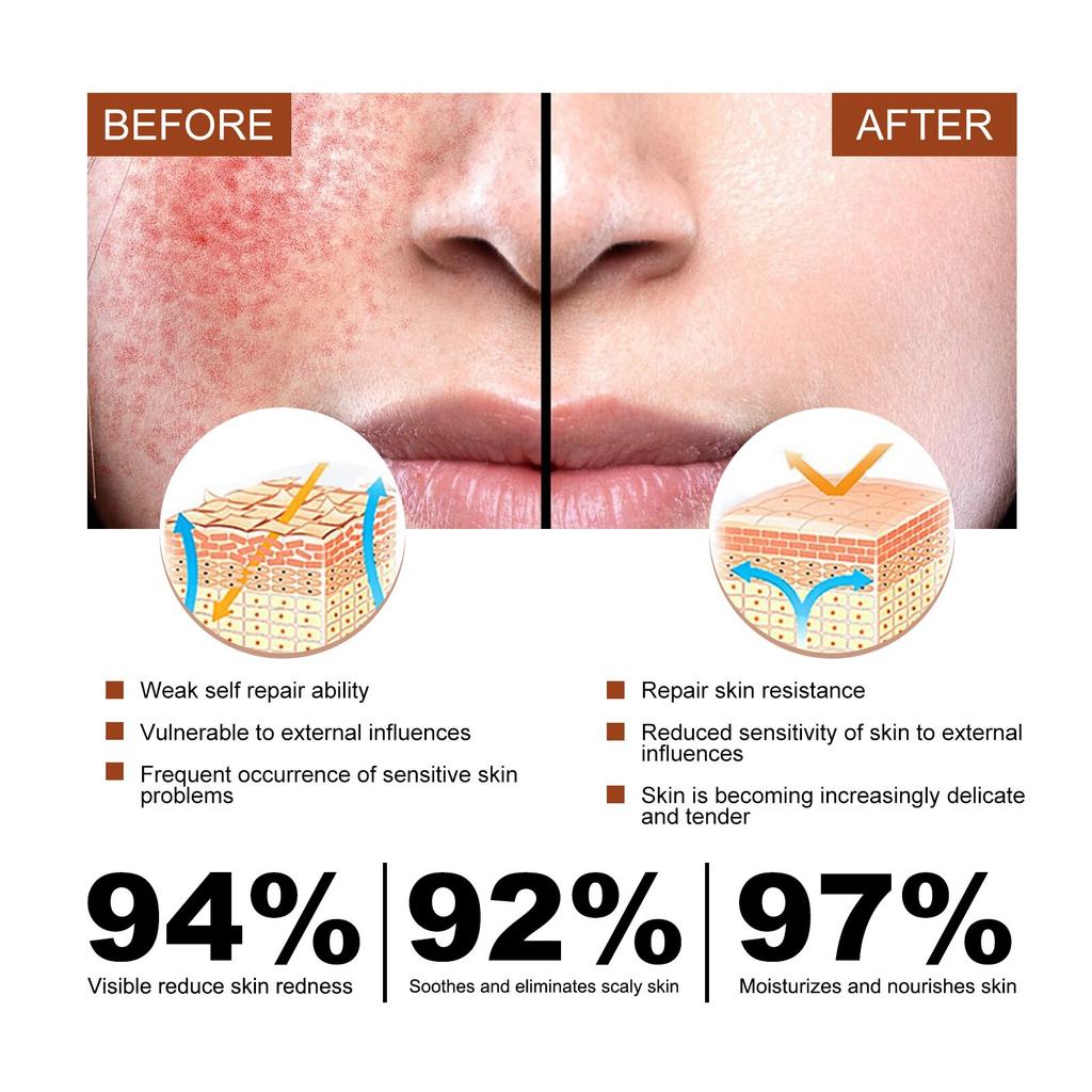 Soothing Repair Serum Redness Relief Hydrating Essence 30ml Face Care Sensitive Skin