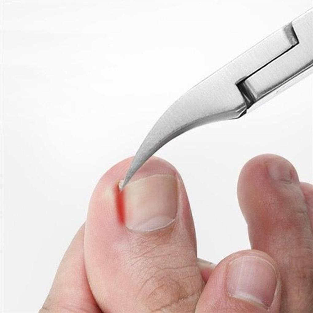 Ingrown toenail care nail nipper nail trimmer cuticle remover