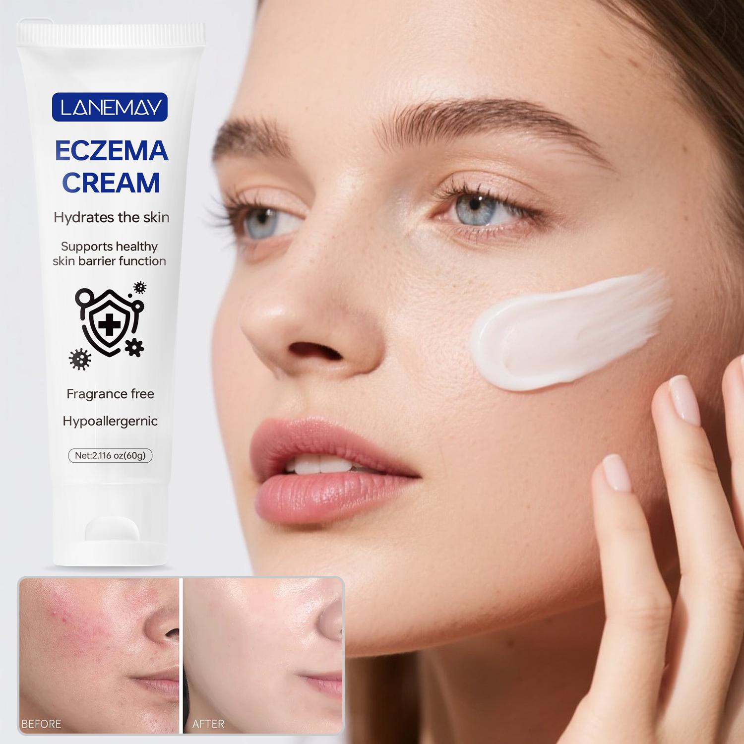 

Eczema Cream-Supports Healthy Skin Barrier Function For Eczema-prone Skin-Clinically Proven To Be Effective-60g