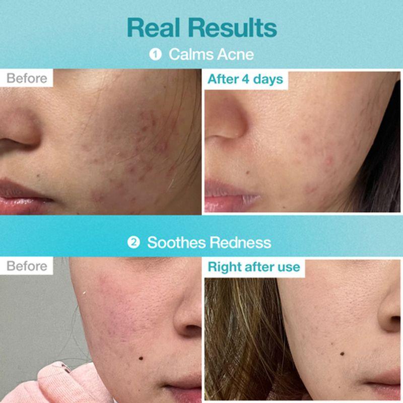 NUMBUZIN No.1 Pantothenic B5 Hyaluronic Active Clear Mask (5ea)