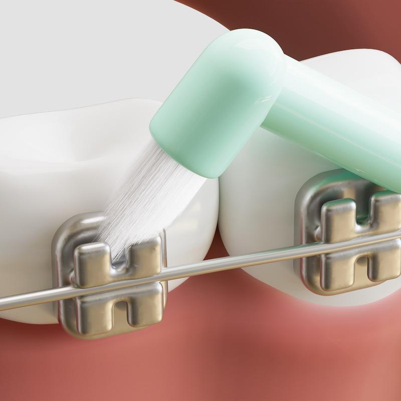 Single-Tuft Toothbrush For Orthodontic Correction, Small Round Head, Wisdom Tooth And Interdental Brush