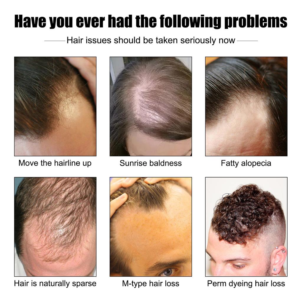 Essence pour cheveux épais pour hommes Solution de soin pour cheveux épais et solides, nutritive, hydratante, anti-chute