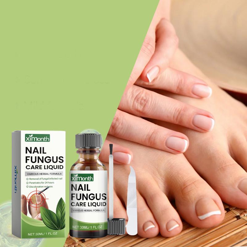 Conjunto Avançado Ximonth para Reparação de Unhas dos Pés e das Mãos para Cuidado de Unhas Saudáveis e Bonitas