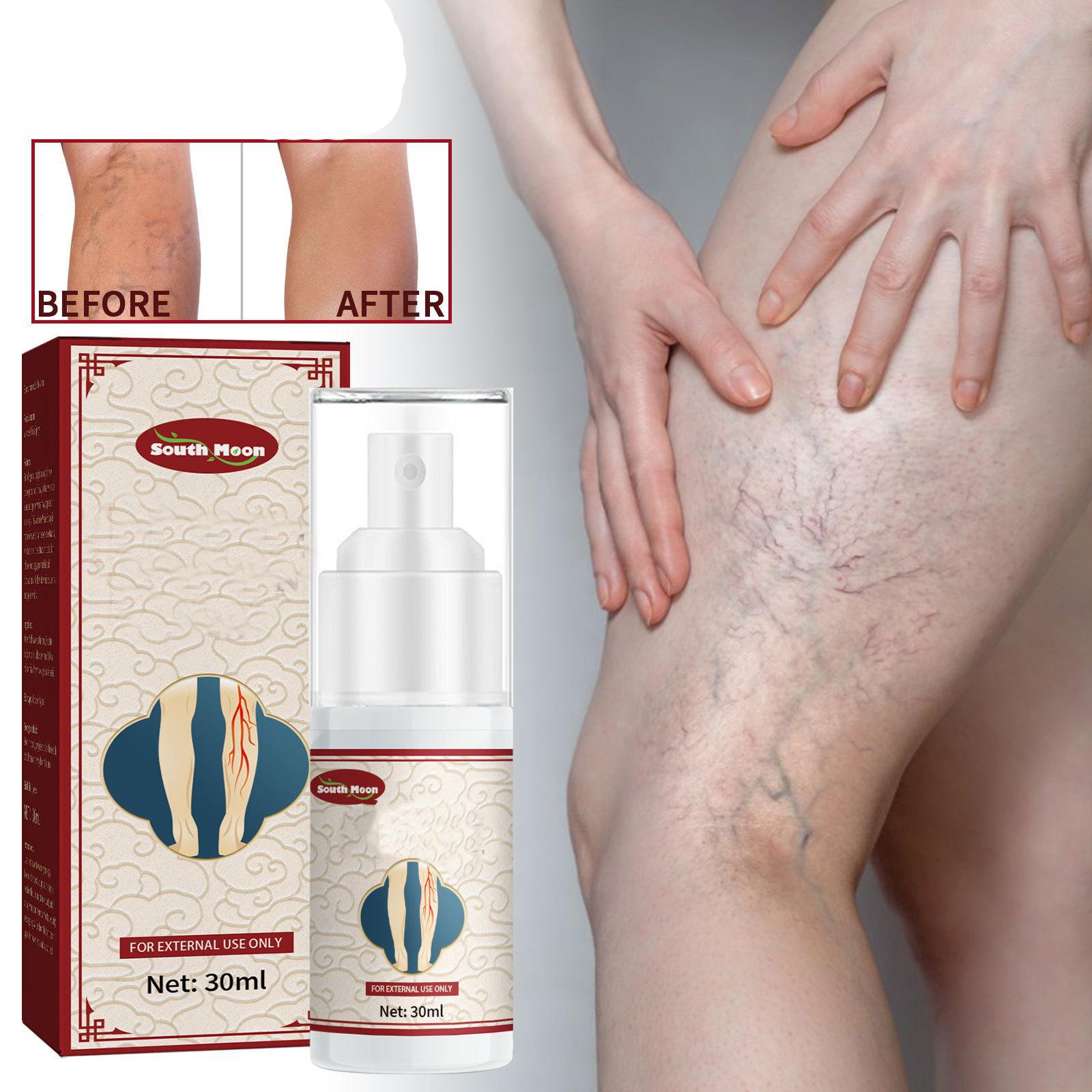 

Пластыри Противовоспалительные пластыри для ног Дождевой червь для ног Синяя вена Выпуклость Боль Maikang Уход за ногами 30 ml