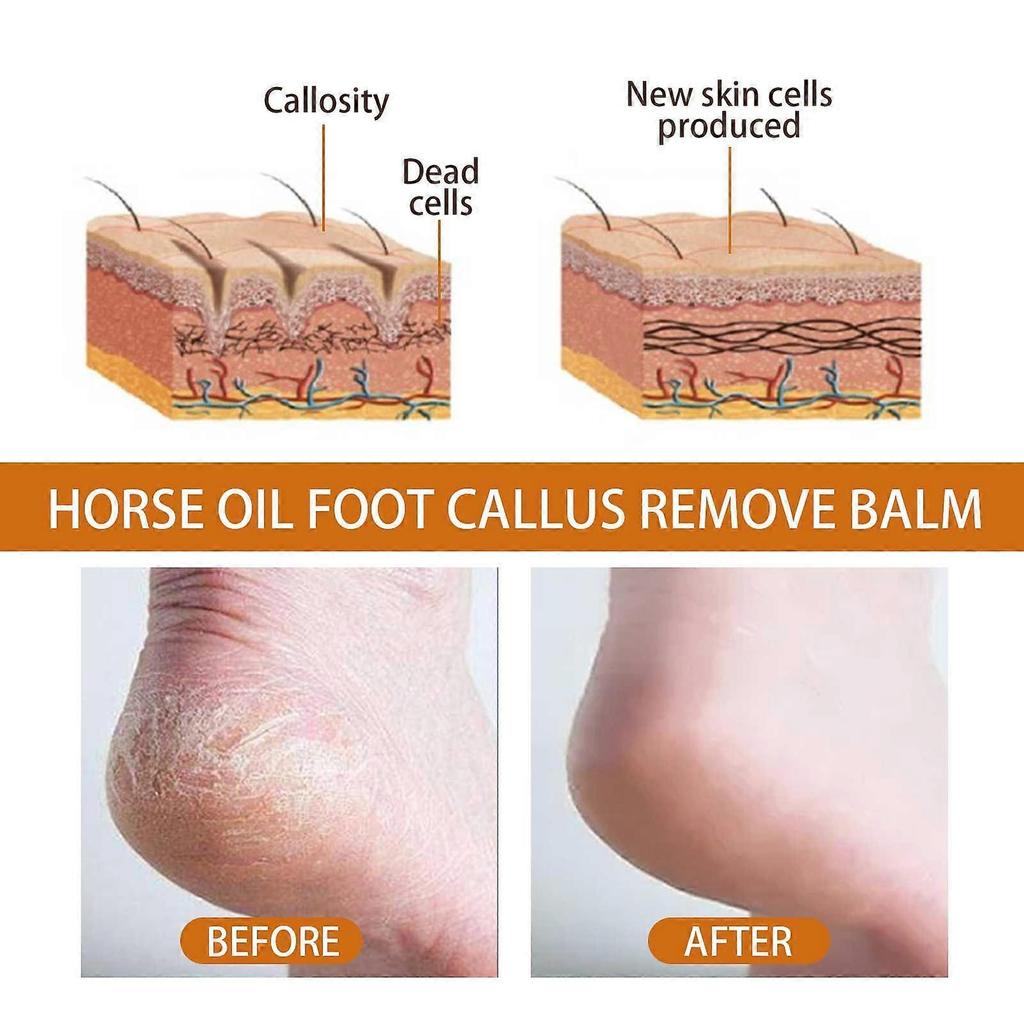Ouhoe Foot Spray Exfoliating Anti-Chapping Repair Rough Skin Moisturizing Care Spray