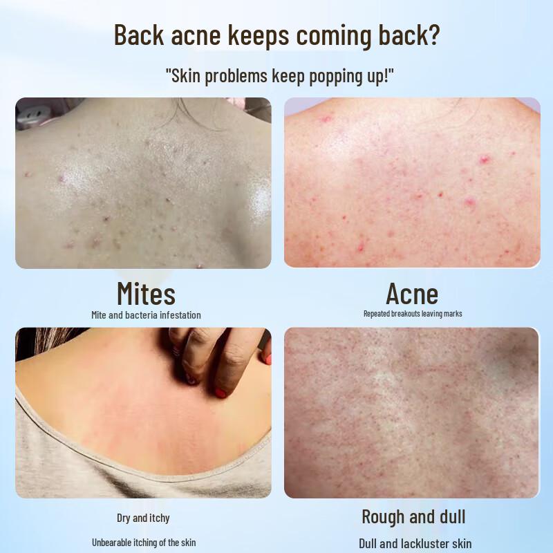 

Lishikang Сера Против Клещей 3-в-1 Гель для Душа