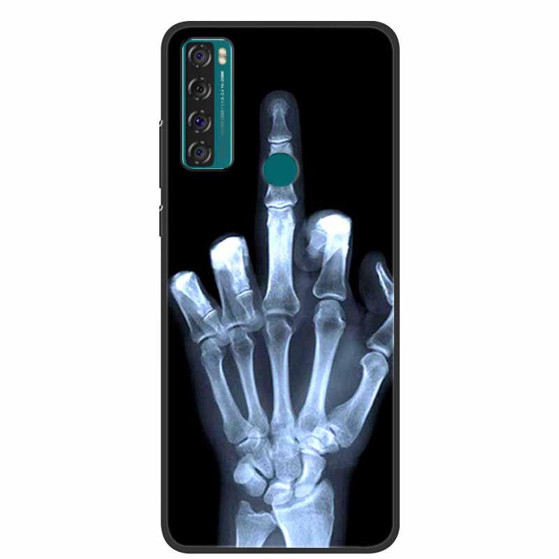 Case For TCL 20 SE Luxury Silicone TPU Soft Phone Cover For TCL 20 SE Case T671H 6.82" Funda Animal Capa Cute Shockproof Coque