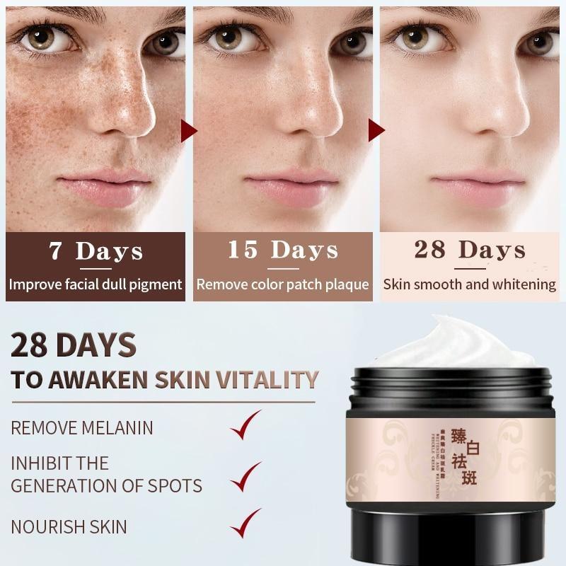 Powerful Whitening Freckle Cream Plant Face Cream Remove Freckles and Dark Spots 30g