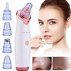 Electric Black Head Removal Face Vacuum Blackhead Instrument Blackhead Remover Vacuum Pore Cleaner