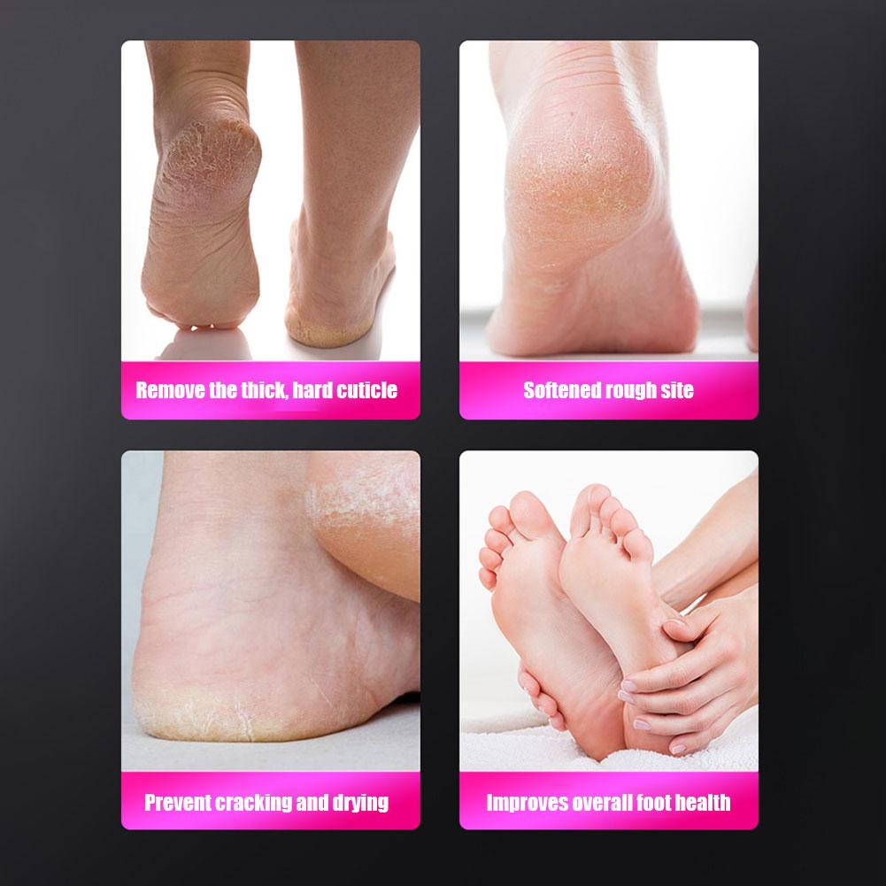 2-in-1 Electric Foot Callus Remover with Sandpaper Discs & Grinding Heads Electric Foot File Electric Pedicure Tool for Home Use