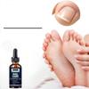 5ML/15ML/30ML/50ML/Crazylife Hand And Foot Nail Onycho Repair Nail Onychomycetant For Thickening Nail Suppressant