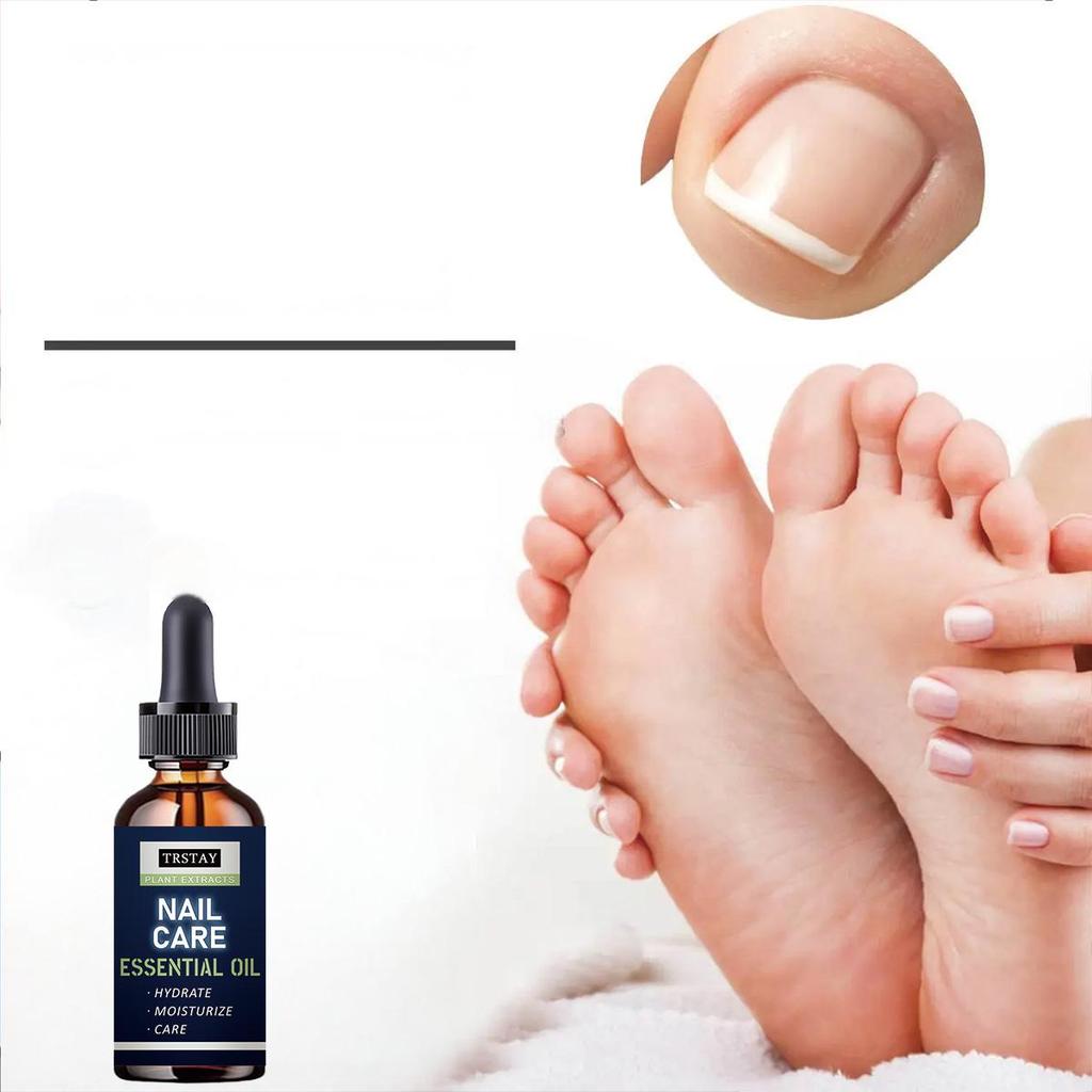 5ML/15ML/30ML/50ML/Crazylife Hand And Foot Nail Onycho Repair Nail Onychomycetant For Thickening Nail Suppressant