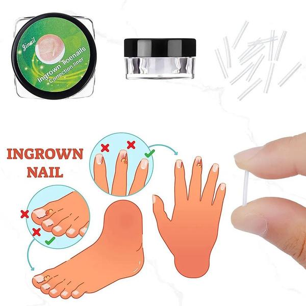 10pcs / Box Ingrown Nail Pad Nail Filling Nail Groove Pad Ingrown Nail Corrector Ingrown Nail Artifact Foot Care Tools