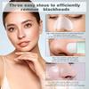 Deep Cleansing Blackhead and Whitehead Removal Tool for Nose and Face - Skin Pore Cleaner for Women Skin Care Beauty Tools