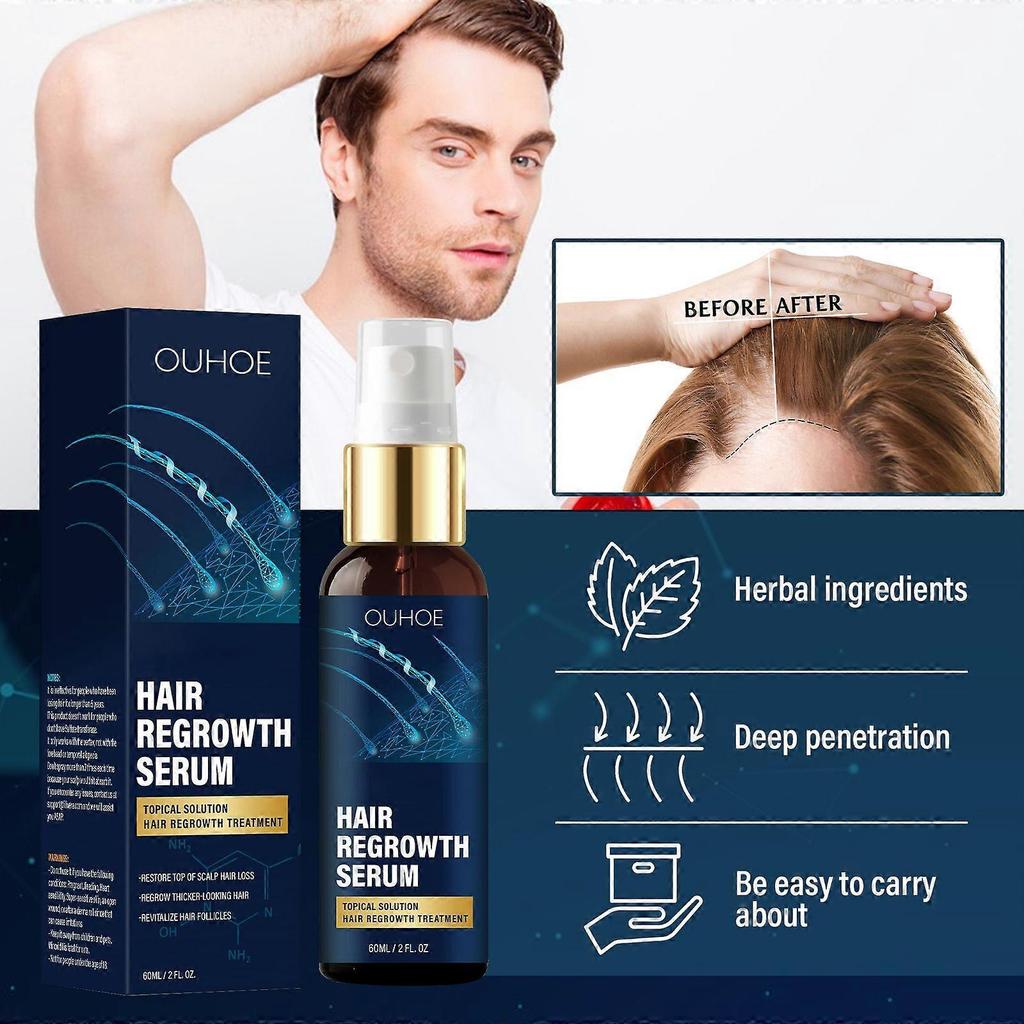 Limited time!!Ouhoe Anti-Hair Loss Density Essence - Nourishes Hairline, Moisturizes Dry Hair, Repairs Hair Roots, And Promotes Hair Growth