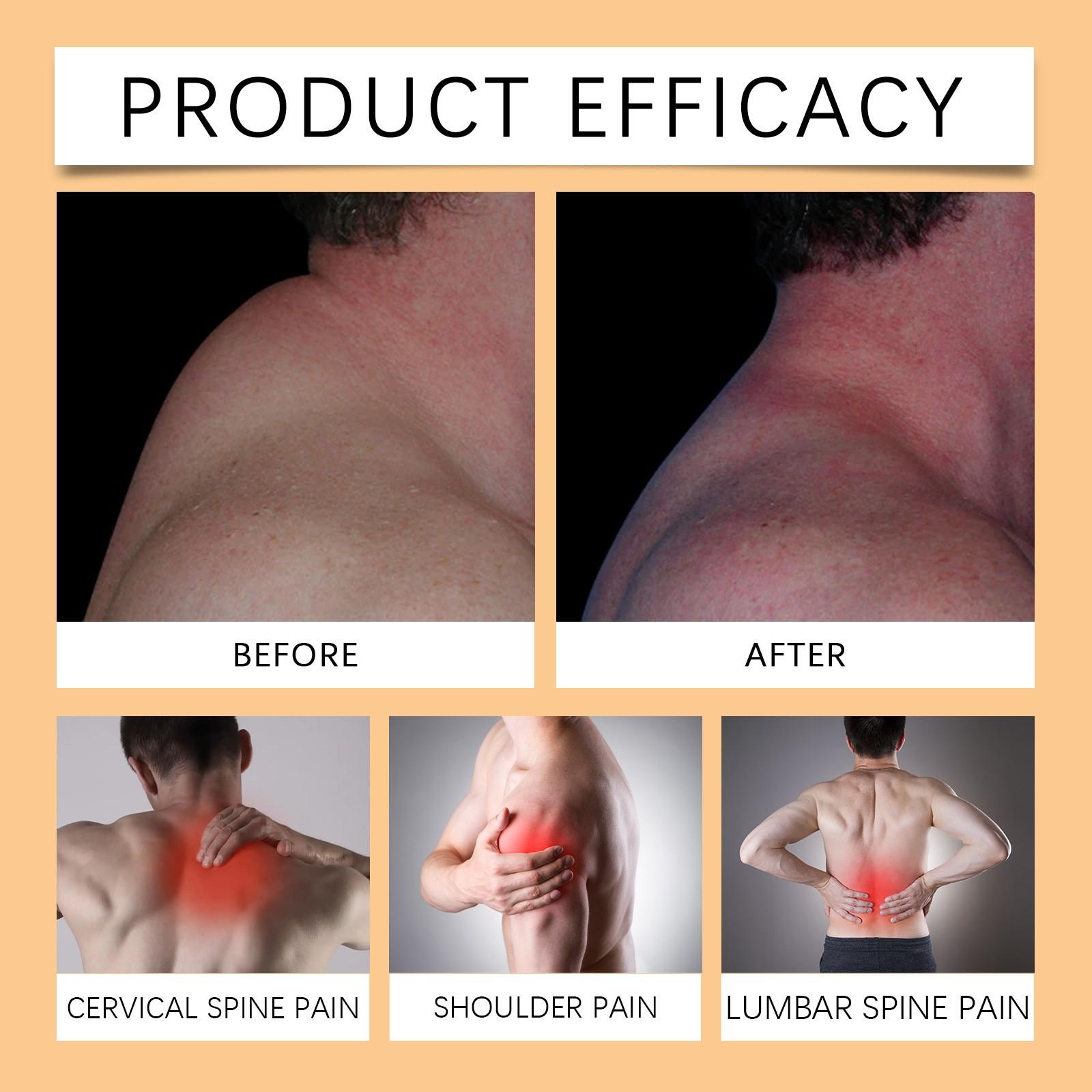 Пластырь для облегчения ухода за плечами — фото 2