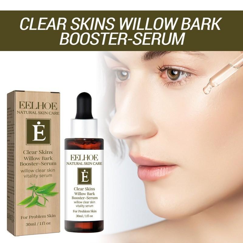 Eelhoe Clear Skin Willow Bark Essence Nourishing Moisturizer For Dry Skin And Acne Scars