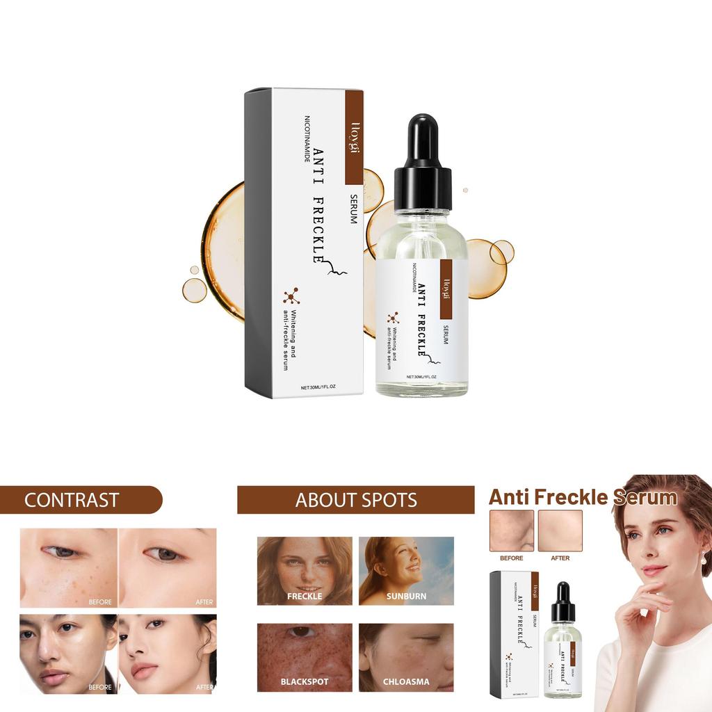 Hoygi Niacinamide Spot Brightening Serum Hydrating And Nourishing Skin Treatment For Dark Spots And Dull Complexion