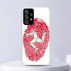 Isle of Man Coat of Arms Soft Case For Samsung Galaxy A17 A16 A26 A36 A56 A15 A14 A13 A55 A54 A53 Phone Cover A25 A35 A24 A34 A2