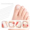 DIY Streifen Positiver Nagelaufkleber Nagelfalz Einrollen Nagel Zugaufkleber Physisches Dehnen Umgekehrte Spannung Eingelegter Nagel Positiver Nagel Patch 5 Stück/Flasche